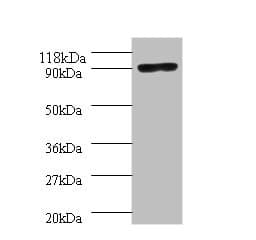 Taq DNA Polymerase Antibody