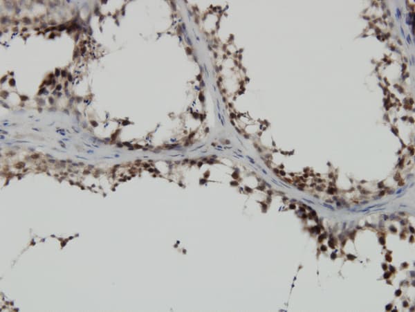 PBK / TOPK Antibody (clone 4A10)