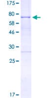 Human HOXA10 Protein (Recombinant GST)