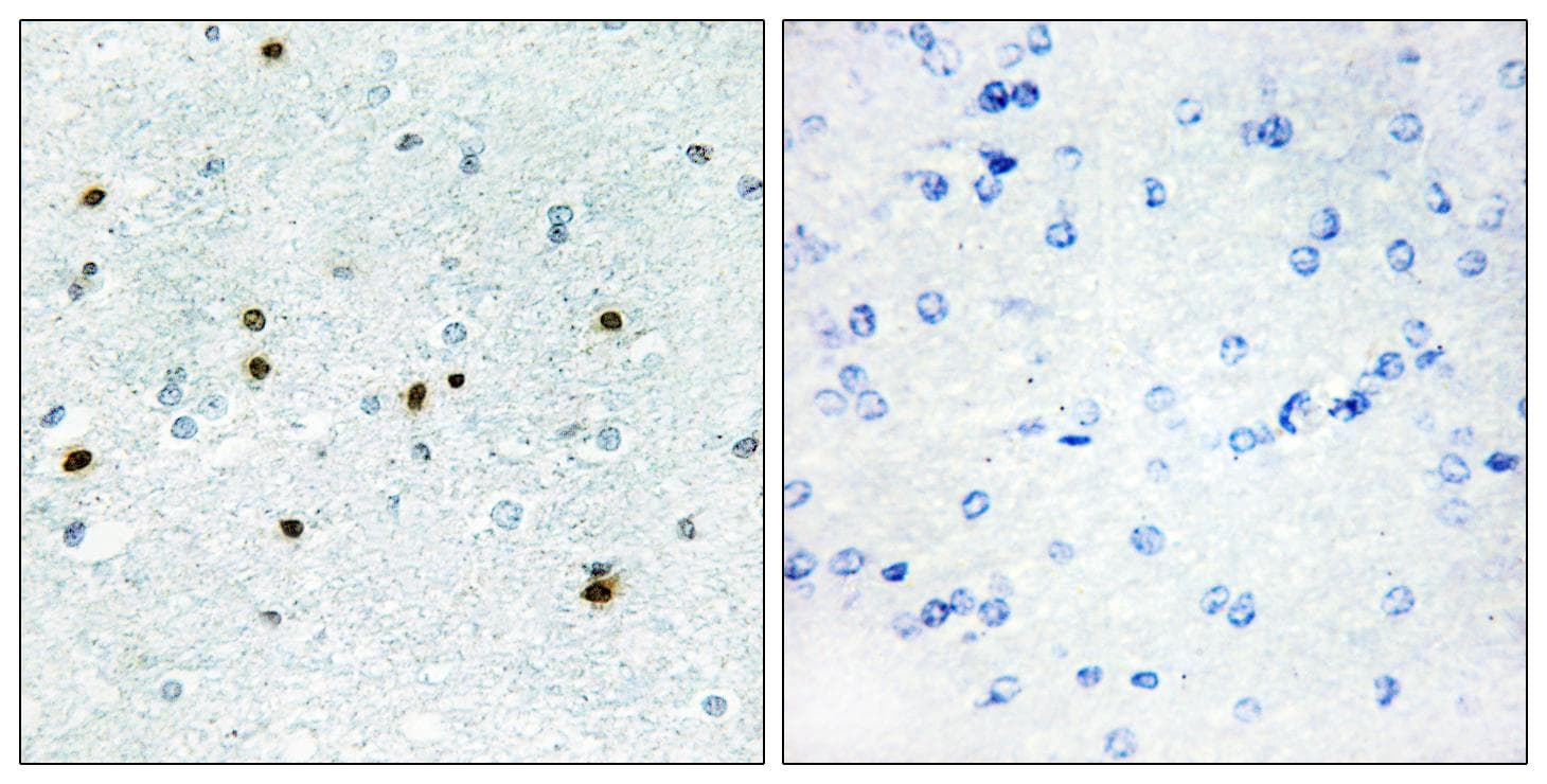 Polyclonal Rabbit anti-Human DCLK3 / CLR Antibody (IHC)