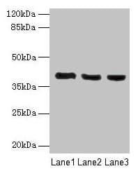 Polyclonal Rabbit anti-Human C9orf64 Antibody (IHC, WB)