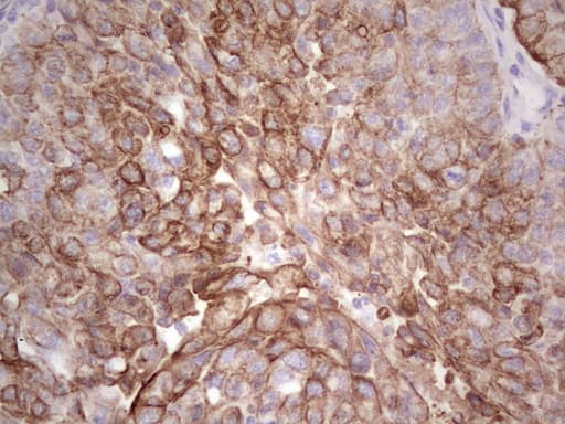 Monoclonal Mouse anti-Human Acidic Cytokeratin AE1 Antibody (clone AE1, IHC)