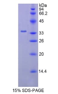 Human HK2 / Hexokinase 2 Protein (Recombinant His)