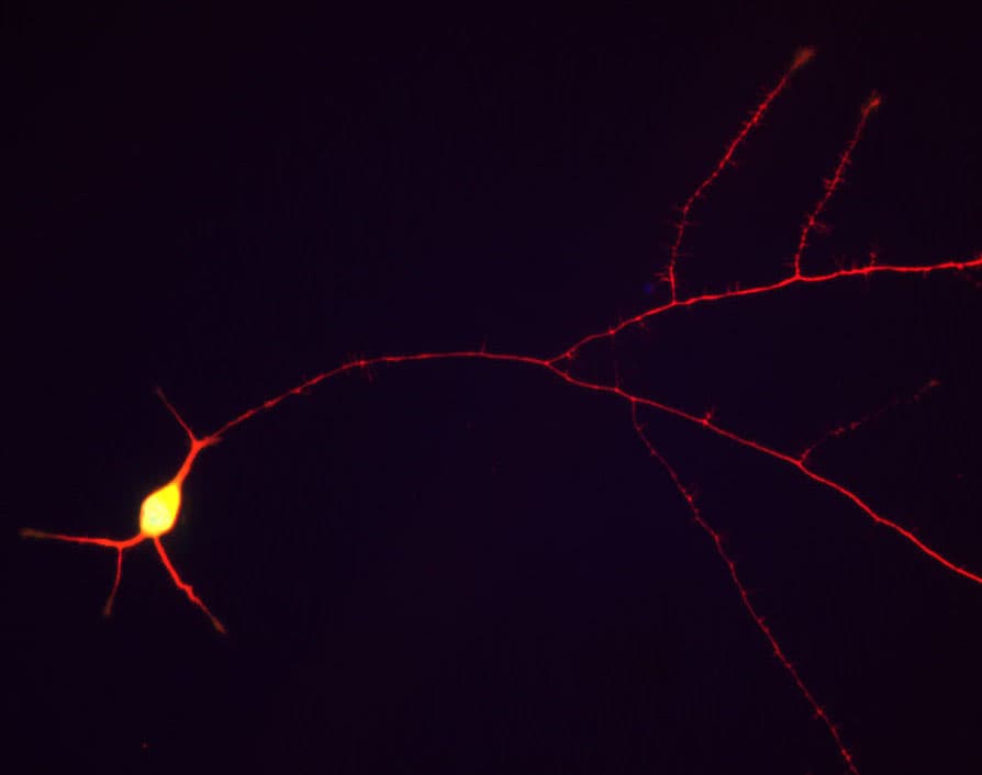 Polyclonal Chicken anti-Human MAPT / Tau Antibody (IF, WB)
