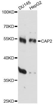 Polyclonal Rabbit anti-Human CAP2 Antibody (WB)