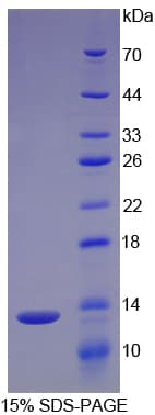 Human ANXA4 / Annexin IV Protein (Recombinant His)