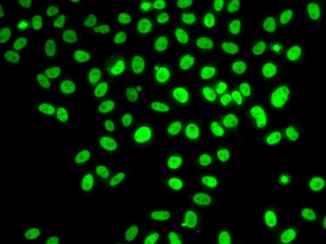 Polyclonal Rabbit anti-Human POLD3 Antibody (IHC, IF, WB)