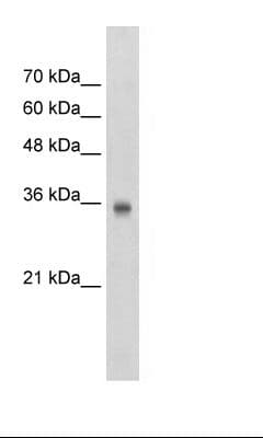 SOX2 Antibody (aa29-78)