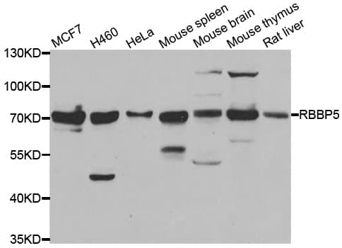 Polyclonal Rabbit anti-Human RBBP5 Antibody (IHC, IF, WB)