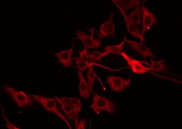 PRSS33 Antibody