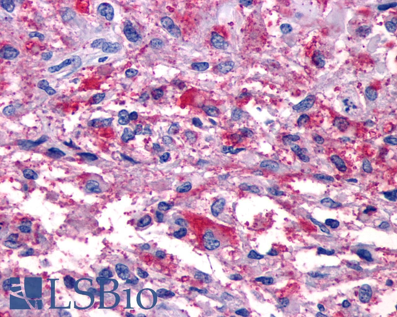 IHC-plus™ P2RY11 / P2Y11 Antibody (Cytoplasmic Domain)