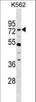Polyclonal Rabbit anti-Human ZNF133 Antibody (aa144-174, WB)