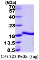 Human A2LD1 Protein (Recombinant His)