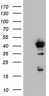 H2AFY2 Antibody (aa2-261, clone OTI1E1, Carrier-free)