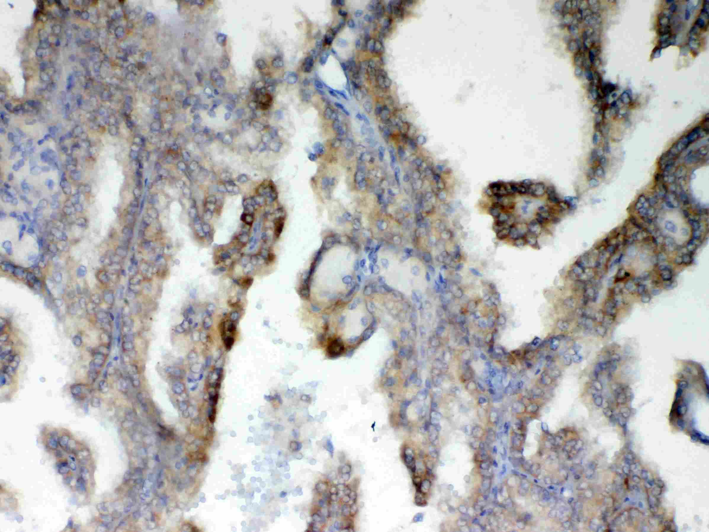 PH / PAH Antibody