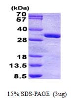 Human PHOSPHO1 Protein (Recombinant His)