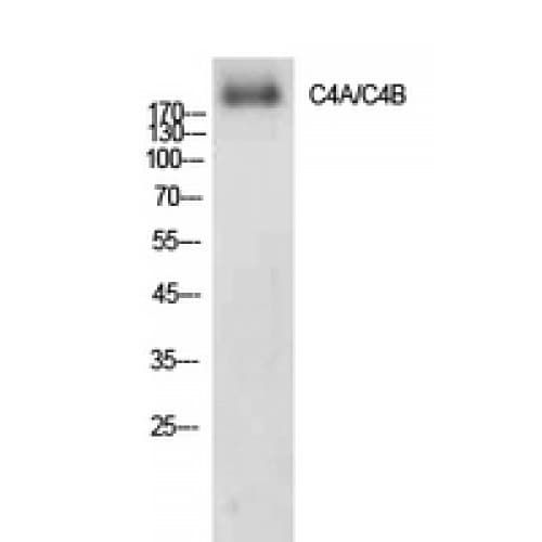 Complement C4a+b Antibody (721-770 aa, Internal)