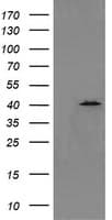 Monoclonal Mouse anti-Human MAPK13 / p38delta Antibody (clone OTI2D1, IF, WB)