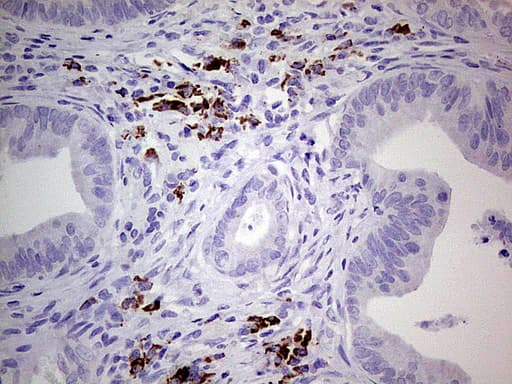 Monoclonal Mouse anti-Human GLI / GLI1 Antibody (clone UMAB170, Carrier-free, aa1-410, IHC, IF, WB)