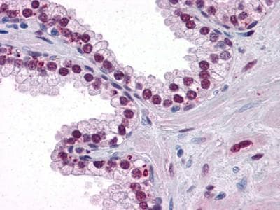 Monoclonal Mouse anti-Human AR / Androgen Receptor Antibody (clone 2H8, IHC, WB)