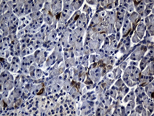 Monoclonal Mouse anti-Human R1 / RRM1 Antibody (clone OTI6G8, aa541-792, IHC, WB)