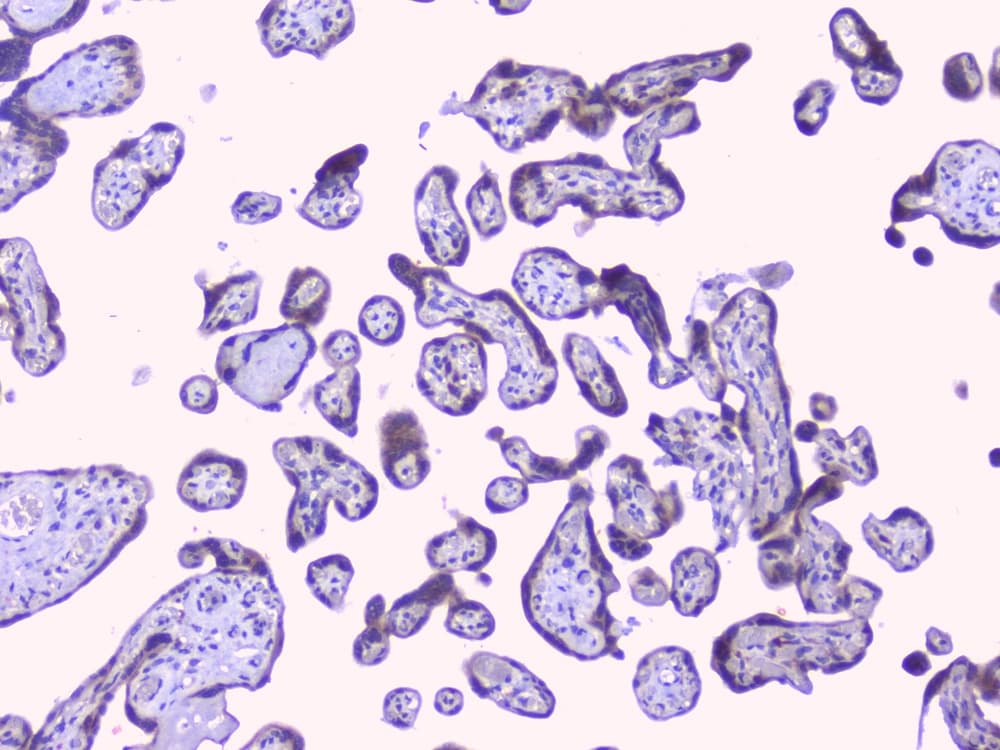 Polyclonal Rabbit anti-Human PTP1B Antibody (IHC, WB)