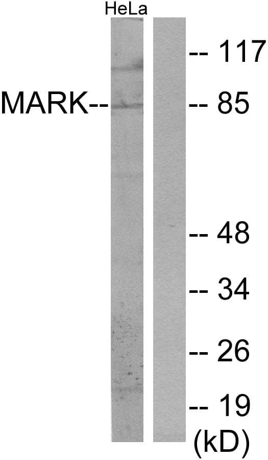 MARK1 / MARK Antibody