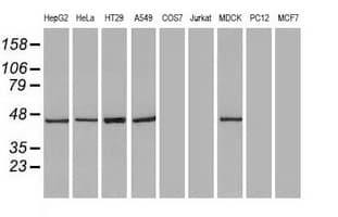 KRT18 / CK18 / Cytokeratin 18 Antibody (clone OTI5E8)