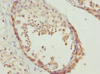 Polyclonal Rabbit anti-Human TESK2 Antibody (IHC)