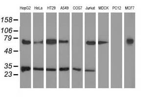 P5CR2 / PYCR2 Antibody (clone OTI2A5, Carrier-free)