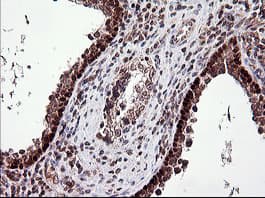 TP73 / p73 Antibody (clone OTI2H2)