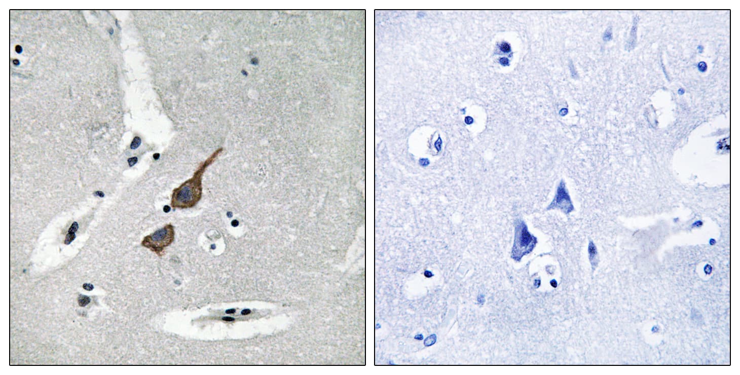 Polyclonal Rabbit anti-Human GRID1 Antibody (aa831-880, IHC, WB)