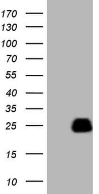 AMTN Antibody (clone OTI1C11)
