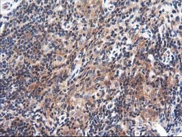 TFG Antibody (clone OTI2C3)
