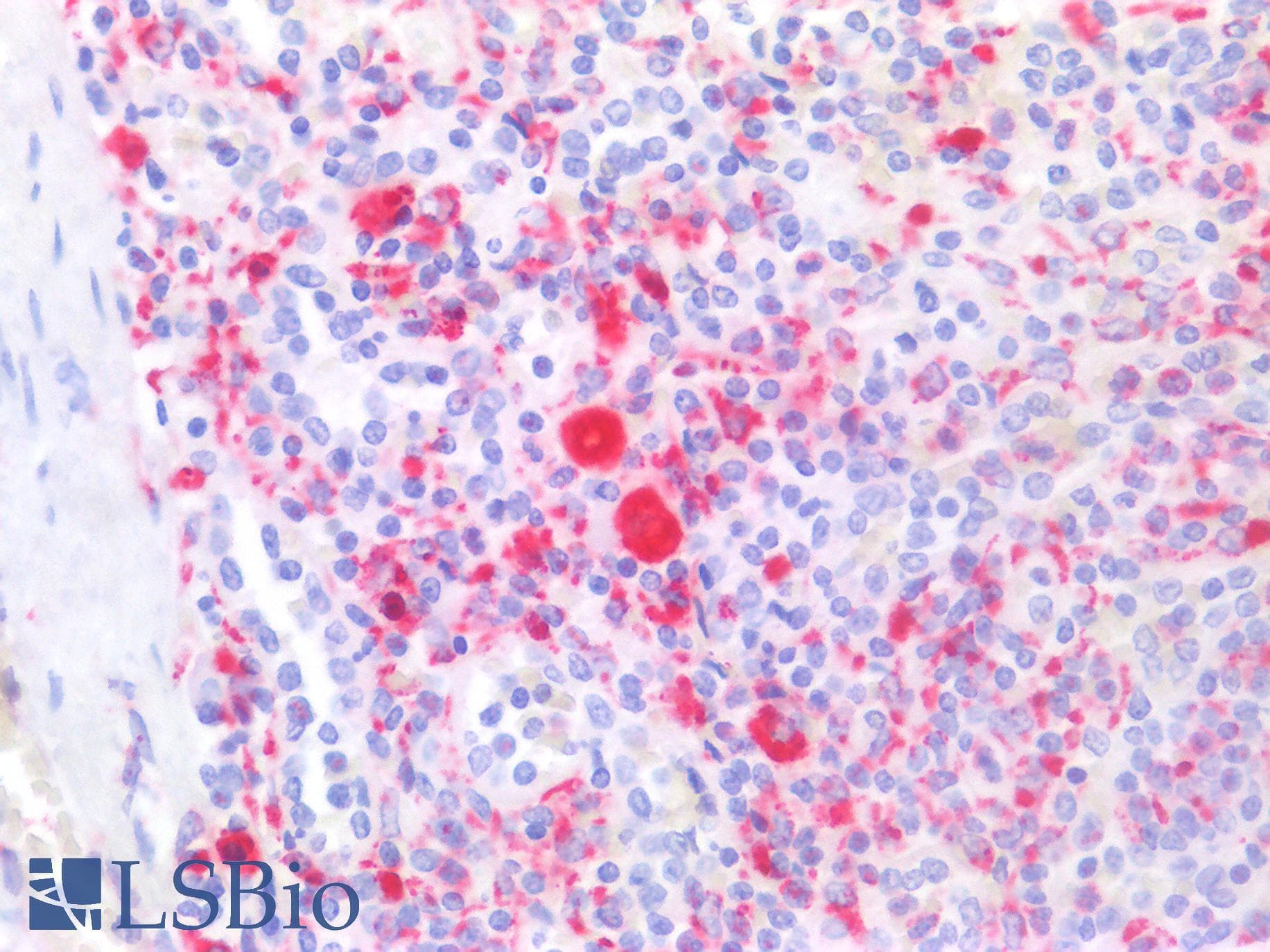 PathPlus™ CD68 Antibody (clone KP-1)