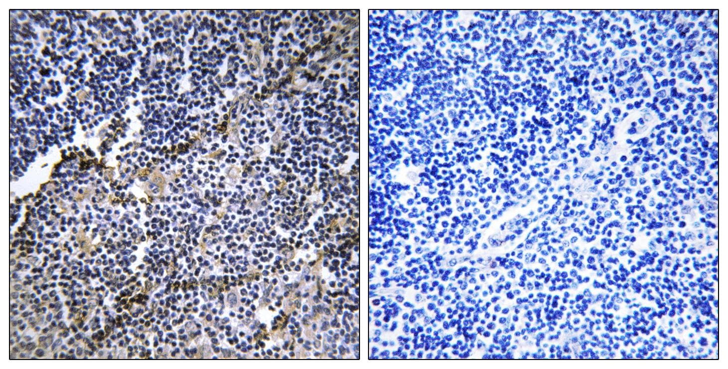Polyclonal Rabbit anti-Human COL19A1 / Collagen XIX Antibody (IHC, IF)