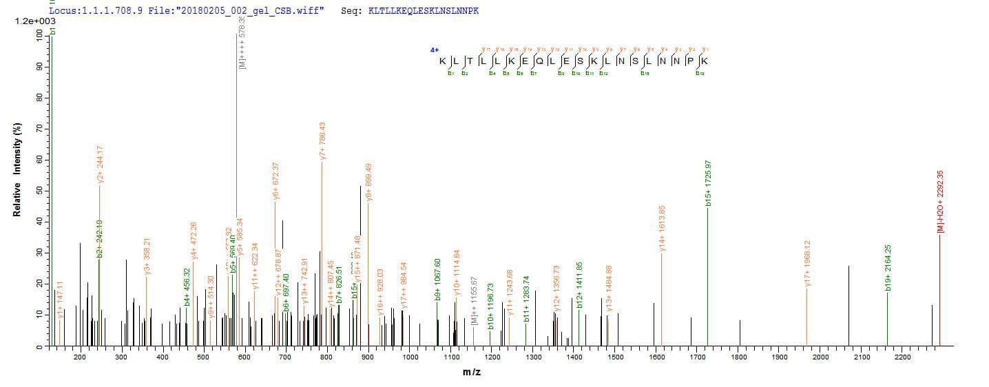 Plasmodium falciparum MSP1 Protein (Recombinant 10His, N-terminus)