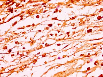 HIST1H1C Antibody