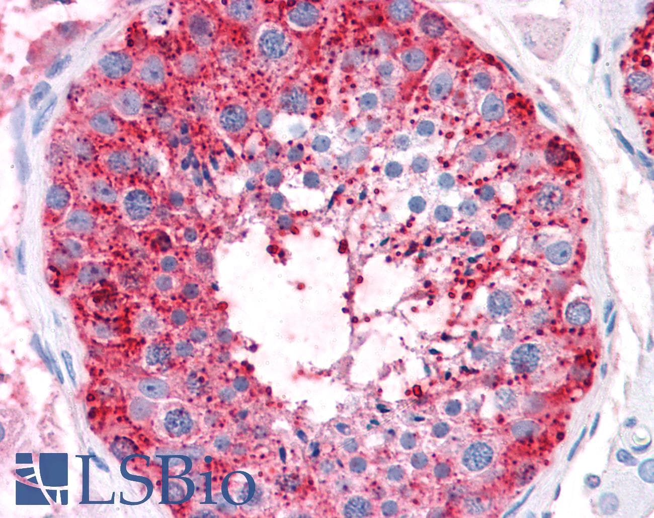 IHC-plus™ Polyclonal Rabbit anti-Human ADAM20 Antibody (Internal, IHC)
