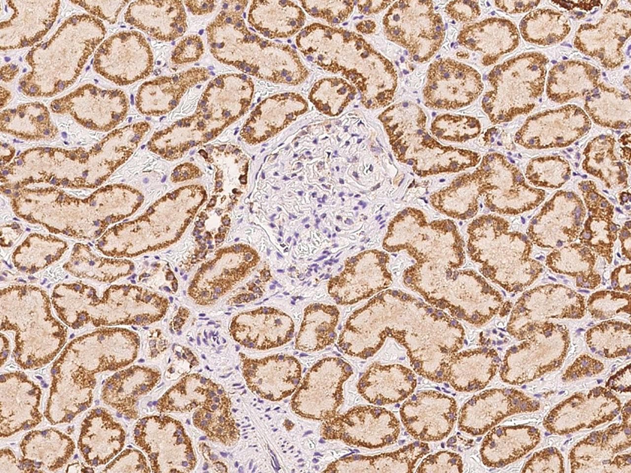 Polyclonal Rabbit anti-Human Gpnat1 / GNPNAT1 Antibody (IHC)