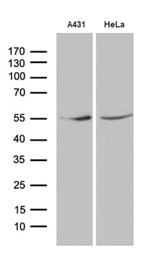 KLF5 / BTEB2 Antibody (aa1, clone OTI1D6)