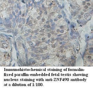 Polyclonal Rabbit anti-Human ZNF490 Antibody (aa170-459, IHC, WB)