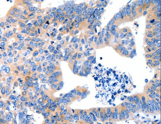 LRPAP1 Antibody