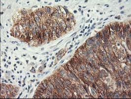 LPL / Lipoprotein Lipase Antibody (clone OTI3A10)