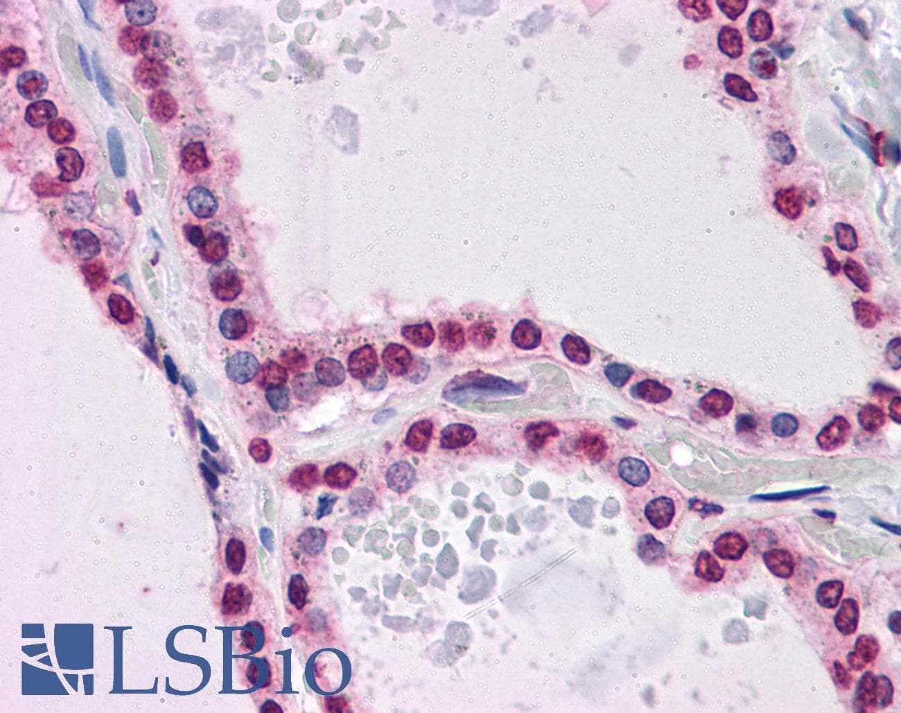 IHC-plus™ KPNA7 Antibody