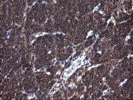 DEF6 Antibody (clone OTI2C11)