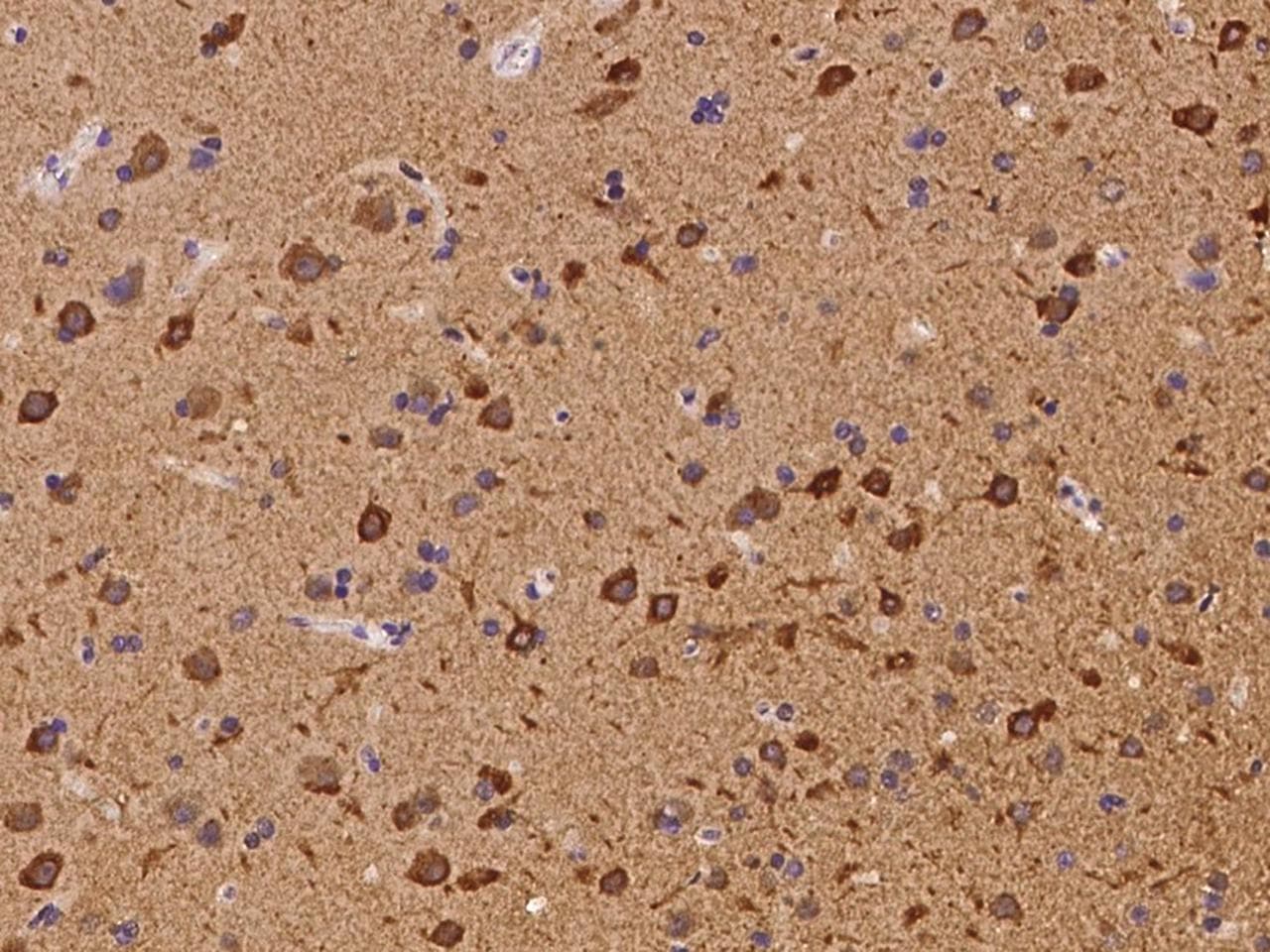 Polyclonal Rabbit anti-Human SH2B3 / LNK Antibody (IHC, IF)