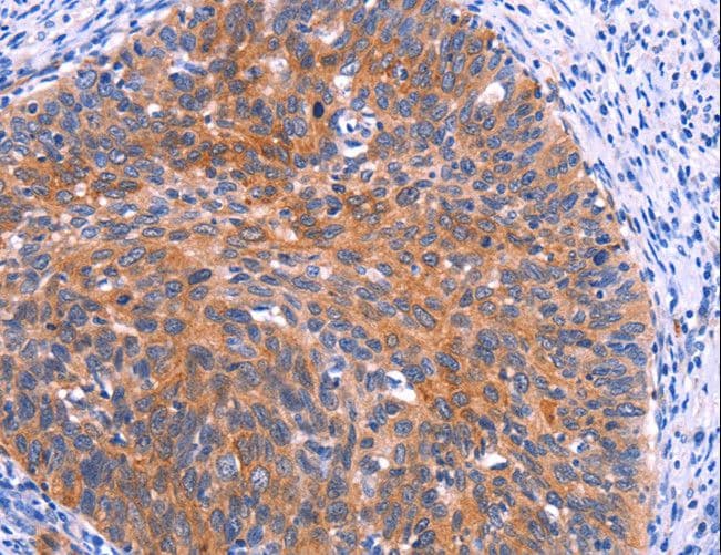 Polyclonal Rabbit anti-Human FAP-1 / PTPN13 Antibody (IHC)