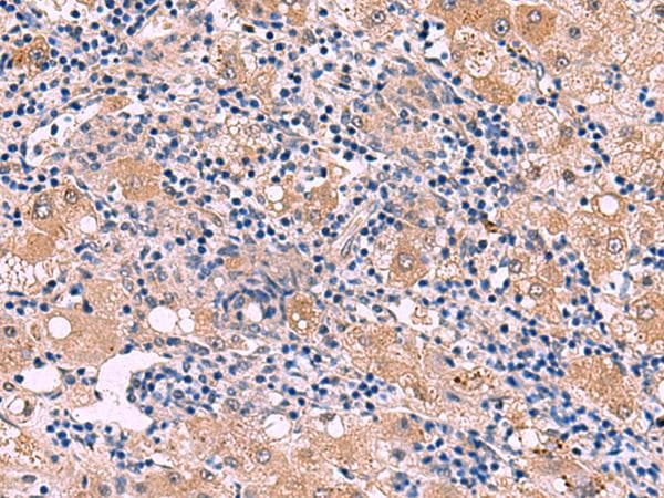 PEPD / PROLIDASE Antibody