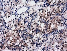 SULT1C2 / Sulfotransferase 1C2 Antibody (clone OTI4G1)